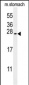 SRTD3 Antibody  (N-term)